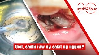 Uod, sanhi raw ng sakit ng ngipin? | Kapuso Mo, Jessica Soho