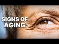 Why Your Eyes Make You Look Older (And How to Fix It)