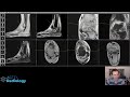 Live MRI interpretation - Ankle