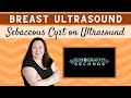 Breast Ultrasound- Sebaceous Cyst (Sonography in Seconds Series)