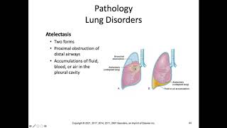 HSC 114 Chapter 12 Lecture Video