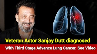 Vetran Actor Sanjay Dutt diagnosed with third stage advance lung cancer. See Video