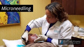 Microneedling [ on Black Skin ] with Dr. Joni Jefferson