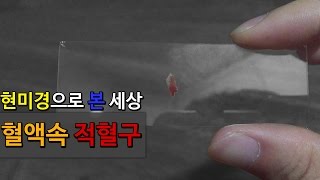 [현미경으로 본 세상] 혈액속 적혈구 #17 (Science Experiments microscope red blood cell)