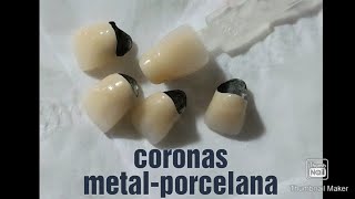 Coronas metal-porcelana [Desde modelado en en cera hasta glazeado]