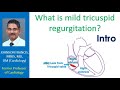 What is mild tricuspid regurgitation? Intro