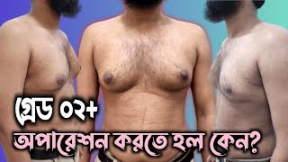 Grade 02+ Gynecomastia Treatment || পুরুষের বড় স্তন ছোট করার চিকিৎসা