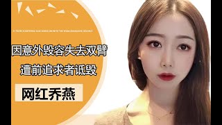 折翼女孩乔燕意外毁容，前追求者：以前看不上我现在送我都不要