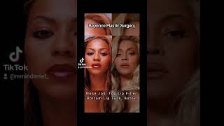 Beyonce Plastic Surgery (The Truth)