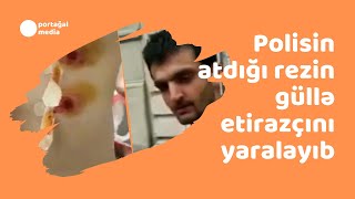 Polisin atdığı rezin güllə etirazçını yaralayıb