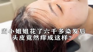 当小姐姐花了六千多后，头皮竟然痒成这样？