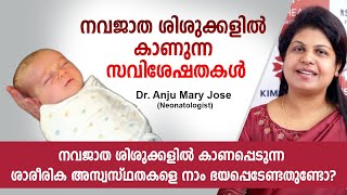 നവജാതശിശുക്കളിൽ കാണപ്പെടുന്ന ശാരീരിക അസ്വസ്ഥതകളെ നാം ഭയപ്പെടേണ്ടതുണ്ടോ? | Malayalam Health Tips