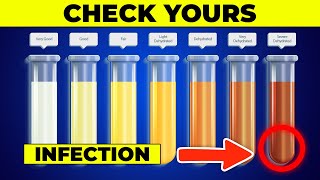 What Do 7 Colors of Your Urine Say About Your Health?