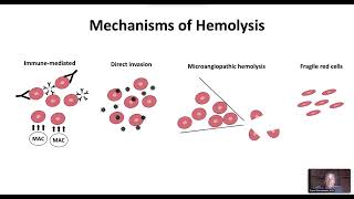 Hemolytic Anemia Overview