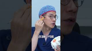 [심부볼지방제거] 심부볼지방의 위치는 어디지?? #Shorts