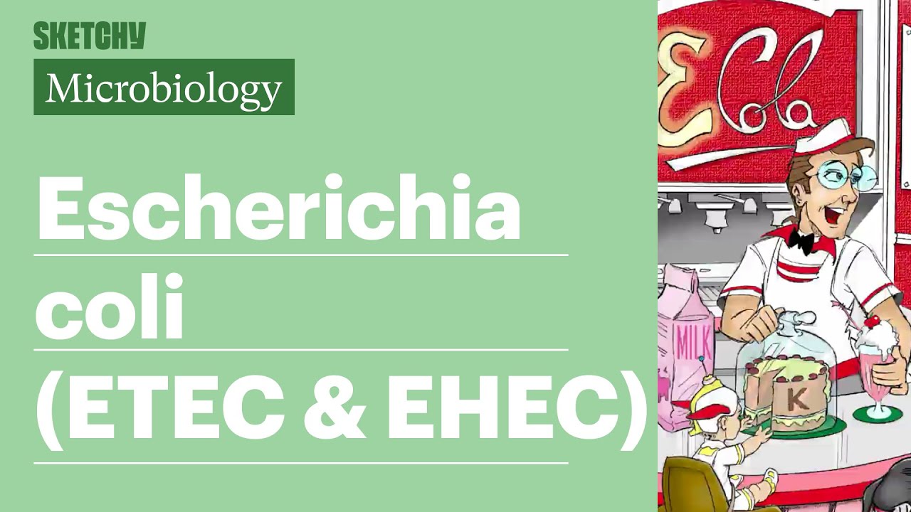 E. Coli ETEC & EHEC Lesson: Types & Factors (Part 1) Sketchy Medical ...