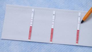 Asante HIV-1 Rapid Test for Recent Infection (RTRI) Tutorial