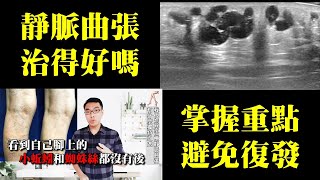 降低復發！治療靜脈曲張的要點｜許原彰醫師：台中，高雄，台南，台北，新竹，靜脈曲張專家