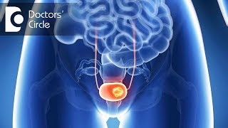 How is Bladder Cancer treated?  What is TURBT? - Dr. Manohar T