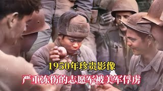 1950年珍贵影像，长津湖战役严重冻伤的志愿军被虏，看着令人泪目