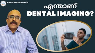 എന്താണ് Dental Imaging? | Dr. Prasanth Pillai's | Smile Centre