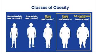 Bariatric Surgery at NYC Health + Hospitals/Metropolitan