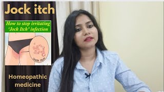 Jock itch ( thigh fungal infection) symptoms,causes,risk factors \u0026 homeopathic medicines in hindi