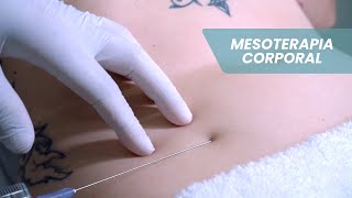 Mesoterapia Corporal - Andrea Soares