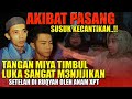 AZAB TANGAN TIMBUL LUKA !! SUSUK NYA DI CABUT OLEH USTAD ANAM, MIYA DURHAKA INGIN MEMBUNOH IBU NYA