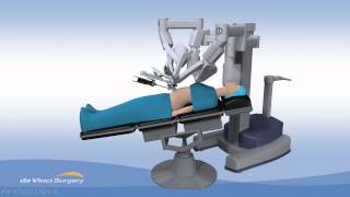 Gall Bladder Removal Using Da Vinci Surgery