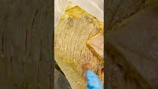 Why Humans Have Big Butts