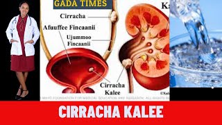 Cirracha kalee  ||kidney stone || Cirrachi kalee akkamitti dhufuu danda'a?