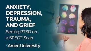 Anxiety, Depression, Trauma & Grief I Seeing PTSD on a SPECT Scan