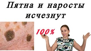 🟢 Пятна и наросты на коже … как избавиться🟢  ( дополнение )