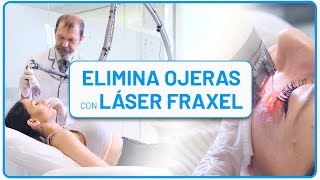 👀 Cómo quitar las OJERAS en solo 5 minutos con LÁSER [TRATAMIENTO DEFINITIVO]