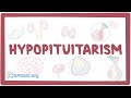 Hypopituitarism - causes, symptoms, diagnosis, treatment, pathology