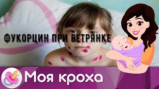 Фукорцин при ветрянке