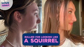 She was bullied for looking like a "SQUIRREL" but spent $200k to replace jaw ✨ | LOVE YOURSELF!
