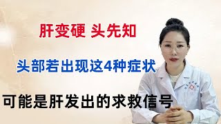 肝变硬，头先知，头部若出现这4种症状，可能是肝发出的求救信号