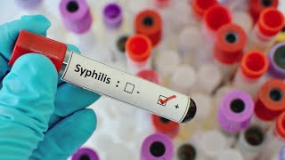 Rising number of Houston syphilis cases being seen in unborn children