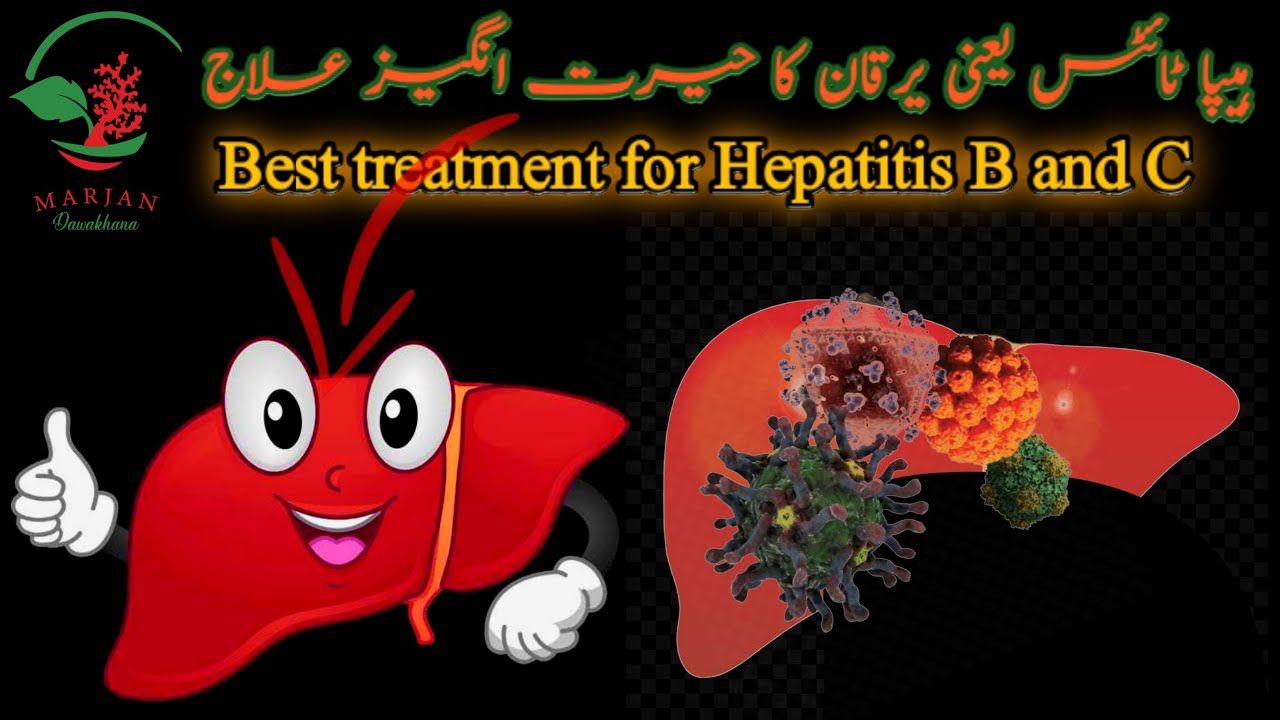 Hepatitis C And B Treatment | Kala Yrkaan | Peela Yarkan | Marjan ...