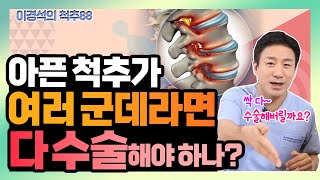 3번, 4번, 5번... 척추 질환이 여러 군데라면, 다 수술해야 하나? - 이경석의 척추88 #73