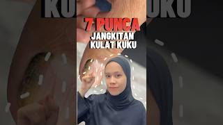 7 punca jangkitan kulat kuku yang mungkin anda tak tahu! #drlyna #kulatkuku #onychomycosis #punca