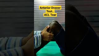 Anterior Drawer Test..ACL Tear...Dr Sai Chandra
