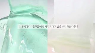 친구들한테 '배아프다고' 반응보기 시리즈 액괴 시액 액시 반응보기액괴