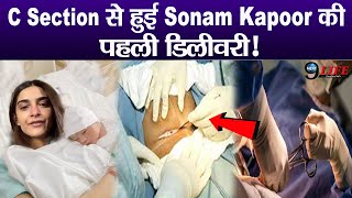 C Section से हुआ Sonam Kapoor के पहले बच्चे का जन्म, रुला देगा सेजरियन Delivery का दर्द...!!