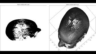 Medical Imaging | 3D Mesh visualization | Head MRI images | python libraries