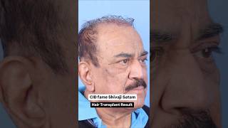 CID fame Acp Pradhuman (Shivaji satam) Hair Transplant Result #shorts #54 #hairstyle