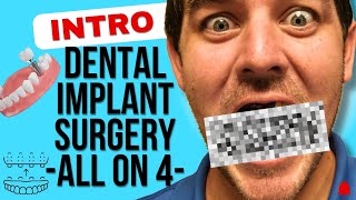 3D Printed FULL SET Dental Implant Surgery (INTRO)