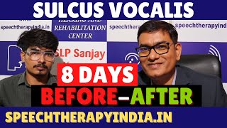 Pre-Post | Sulcus Vocalis | Exercise | Voice Therapy | In 8 Days | By #slpsanjaykumar | Since 2010